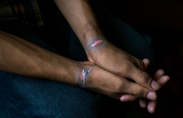 Andrés (Name geändert), 16 Jahre alt, misshandelt von Sicherheitskräften in El Salvador, 12. May 2016.